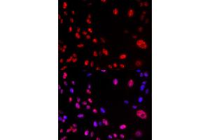 Immunofluorescence (IF) image for anti-Ataxia Telangiectasia Mutated (ATM) (pSer1981) antibody (ABIN1869997)