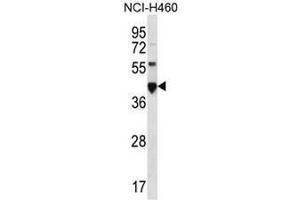 CEACAM18 Antibody (N-term) western blot analysis in NCI-H460 cell line lysates (35µg/lane). (CEACAM18 Antikörper  (N-Term))