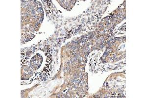 IHC analysis of MUT using anti-MUT antibody (ABIN4886676).