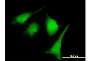 Immunofluorescence of purified MaxPab rabbit antibody to MAP2K2 on HeLa cell.