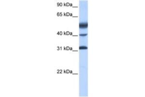 Western Blotting (WB) image for anti-Activating Transcription Factor 1 (AFT1) antibody (ABIN2461743) (AFT1 Antikörper)