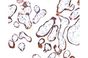 IHC testing of placenta stained with HCG-beta antibody (HCGb/54). (HCG beta Antikörper)