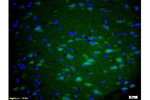 Formalin-fixed and paraffin embedded rat brain labeled with Anti GRM5/mGluR5 Polyclonal Antibody, Unconjugated (ABIN673914) at 1:200 followed by conjugation to the secondary antibody Goat Anti-Rabbit IgG, FITC conjugated used at 1:200 dilution for 40 minutes at 37°C and DAPI staining. (Metabotropic Glutamate Receptor 5 Antikörper  (AA 201-300))