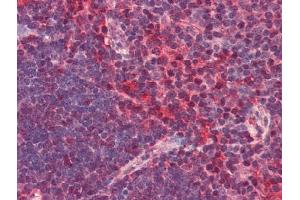 Image no. 1 for anti-Chemokine (C-X-C Motif) Receptor 6 (CXCR6) antibody (ABIN372833) (CXCR6 Antikörper)