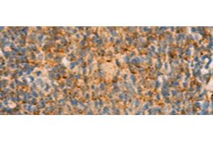 Immunohistochemistry of paraffin-embedded Human tonsil tissue using IFITM2 Polyclonal Antibody at dilution of 1:25(x200) (IFITM2 Antikörper)