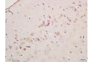 Formalin-fixed and paraffin embedded mouse brain labeled with Anti-Cyclooxygenase-2 Polyclonal Antibody, Unconjugated  at 1:200 followed by conjugation to the secondary antibody and DAB staining (PTGS2 Antikörper  (AA 301-400))