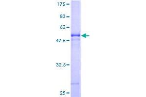 VTI1B Protein (AA 1-232) (GST tag)