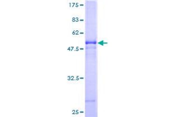 VTI1B Protein (AA 1-232) (GST tag)