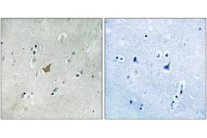 Immunohistochemistry analysis of paraffin-embedded human brain, using EPHA3/4/5 (Phospho-Tyr779/833) Antibody. (EPH Receptor A3 Antikörper  (pTyr779))