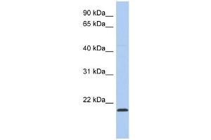 RWDD4A antibody used at 1 ug/ml to detect target protein. (RWDD4A Antikörper  (Middle Region))