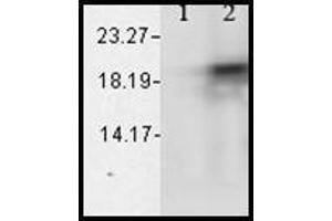 Western blot analysis of Alpha B Crystallin showing its absolte specificity.