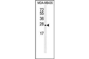 Western blot analysis of LIN28 Antibody  in MDA-MB435 cell line lysates (35ug/lane).