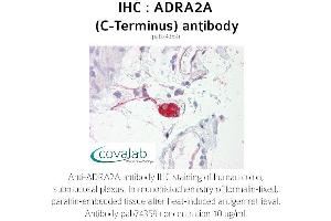 Image no. 1 for anti-Alpha-2A Adrenergic Receptor (ADRA2A) antibody (ABIN1731578) (ADRA2A Antikörper)