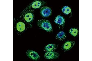 Immunofluorescence (IF) image for anti-SMAD Family Member 4 (SMAD4) (pThr277) antibody (ABIN3001788) (SMAD4 Antikörper  (pThr277))
