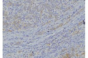 ABIN6277564 at 1/100 staining Human gastric tissue by IHC-P. (CYB5A Antikörper  (Internal Region))