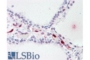 ABIN238640 (5µg/ml) staining of paraffin embedded Human Thyroid. (ATP13A1 Antikörper  (Internal Region))