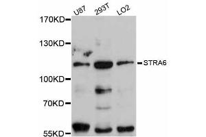 Western blot analysis of extracts of various cell lines, using STRA6 antibody (ABIN5998994) at 1:3000 dilution.