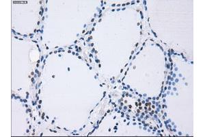 Immunohistochemical staining of paraffin-embedded Kidney tissue using anti-PSMA7mouse monoclonal antibody. (PSMA7 Antikörper)