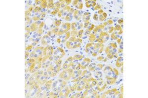 Immunohistochemistry of paraffin-embedded rat kidney using FAS Antibody (ABIN5970062) at dilution of 1/100 (40x lens).
