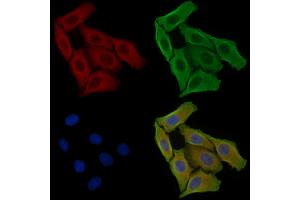 ABIN6256932 and ABIN6275042 staining Hela cells by IF/ICC. (Coxsackie Adenovirus Receptor Antikörper  (N-Term))