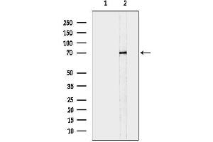 anti-ATP-Binding Cassette, Sub-Family D (Ald), Member 4 (ABCD4) (Internal Region) antibody