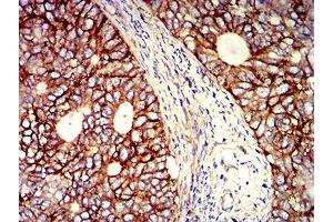 Immunohistochemistry (IHC) image for anti-CD276 (CD276) (AA 29-466) antibody (ABIN5611271)