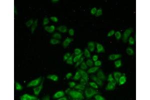 Figure:FITC staining on IHC-P Simple: Hela cells (SHMT2 Antikörper  (AA 30-504))