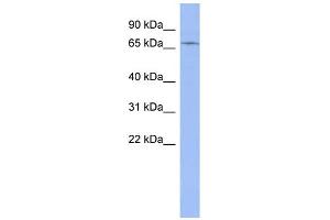 WB Suggested Anti-ZNF133 Antibody Titration:  0. (ZNF133 Antikörper  (Middle Region))