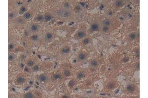Immunohistochemistry (IHC) image for anti-Glutamate-Cysteine Ligase, Modifier Subunit (GCLM) (AA 40-251) antibody (ABIN7433051)