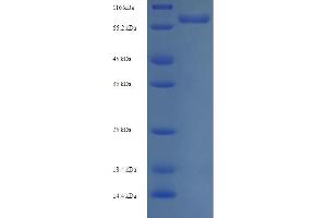 SDS-PAGE (SDS) image for UDP-Glucose 6-Dehydrogenase (UGDH) (AA 1-494), (full length) protein (His-SUMO Tag) (ABIN5710598) (UGDH Protein (AA 1-494, full length) (His-SUMO Tag))
