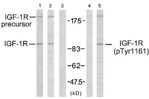 Western blot analysis using IGF-1R (Ab-1161) antibody (Line 1, 2 and 3) and IGF-1R (phospho-Tyr1161) antibody (Line 4 and 5). (IGF1R Antikörper  (pTyr1161))