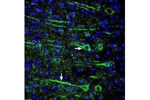 Expression of Slitrk1 in rat cortex - Immunohistochemical staining of perfusion-fixed frozen rat brain sections using Anti-Slitrk1 (extracellular) Antibody (ABIN7043629, ABIN7045304 and ABIN7045305), (1:300), followed by goat anti-rabbit-AlexaFluor-488.