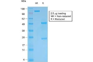 SDS-PAGE Analysis Purified Multi-Cytokeratin Mouse Recombinant Monoclonal Antibody (rKRT/457). (Rekombinanter Cytokeratin, Multi (Epithelial Marker) Antikörper)