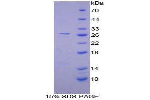 SDS-PAGE (SDS) image for Calcium/calmodulin-Dependent Protein Kinase II gamma (CAMK2G) (AA 6-208) protein (His tag) (ABIN1879728)