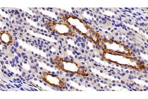 Immunohistochemistry (IHC) image for anti-Keratin 7 (KRT7) (AA 91-394) antibody (ABIN7432025)