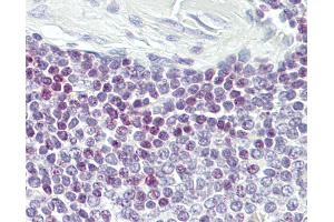 Immunohistochemistry (IHC) image for anti-E74-Like Factor 1 (Ets Domain Transcription Factor) (ELF1) (AA 142-191) antibody (ABIN6749695)