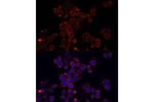 Immunofluorescence analysis of HeLa cells using MTOR antibody (ABIN6292920) at dilution of 1:100. (MTOR Antikörper)