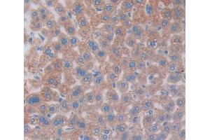 IHC-P analysis of Kidney tissue, with DAB staining. (Vitronectin Antikörper  (AA 19-468))