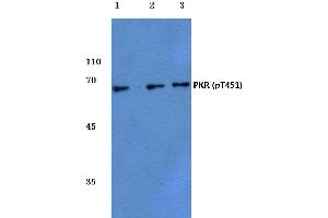 Western blot (WB) analysis of p-PKR antibody at 1/500 dilution (EIF2AK2 Antikörper  (pThr451))