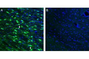 Expression of ACE2 in mouse thalamus. (Angiotensin I Converting Enzyme 2 (ACE2) Peptid)