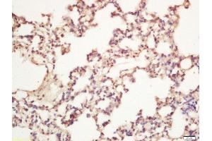 Formalin-fixed and paraffin embedded rat lung labeled with Rabbit Anti-AMBRA1 Polyclonal Antibody, Unconjugated 1:200 followed by conjugation to the secondary antibody and DAB staining