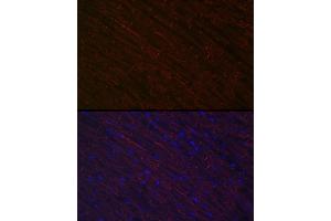 Immunofluorescence analysis of rat heart using Desminmin Rabbit pAb (ABIN3021114, ABIN3021115, ABIN3021116 and ABIN6213957) at dilution of 1:100 (40x lens). (Desmin Antikörper  (AA 121-470))