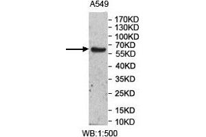 Western Blotting (WB) image for anti-UDP Glucuronosyltransferase 2 Family, Polypeptide A3 (UGT2A3) antibody (ABIN1856379) (UGT2A3 Antikörper)