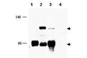 Western blot using  affinity purified anti-MECT1 antibody shows detection of endogenous MECT1 (lower arrowhead) and MECT1-MAML2 fusion protein (top arrowhead) in cell lysates. (CRTC1 Antikörper  (AA 19-34))