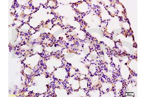 Immunohistochemistry (IHC) image for anti-Coagulation Factor III (thromboplastin, Tissue Factor) (F3) (AA 32-100) antibody (ABIN708086)