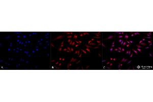 Immunocytochemistry/Immunofluorescence analysis using Rabbit Anti-GRP78 Polyclonal Antibody (ABIN361824 and ABIN361825).