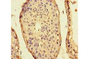 Immunohistochemistry of paraffin-embedded human testis tissue using ABIN7169848 at dilution of 1:100