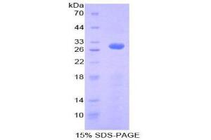 SDS-PAGE (SDS) image for Ribonuclease/angiogenin Inhibitor 1 (RNH1) (AA 218-444) protein (His tag) (ABIN1879320)