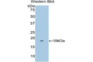 Western blot analysis of the recombinant protein. (Periostin Antikörper  (AA 500-630))