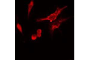 ABIN6274747 staining HeLa cells by IF/ICC. (RPS11 Antikörper  (C-Term))